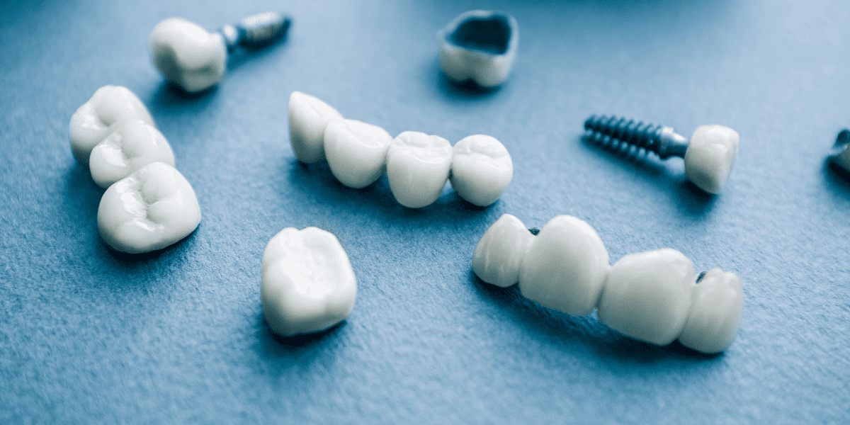 先天性欠如歯（永久歯が生えない/大人乳歯）の対策